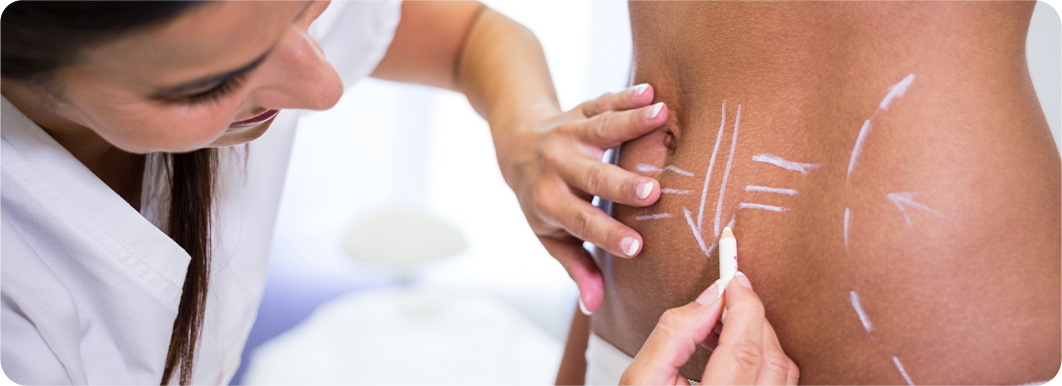 Optimized Responsive Image