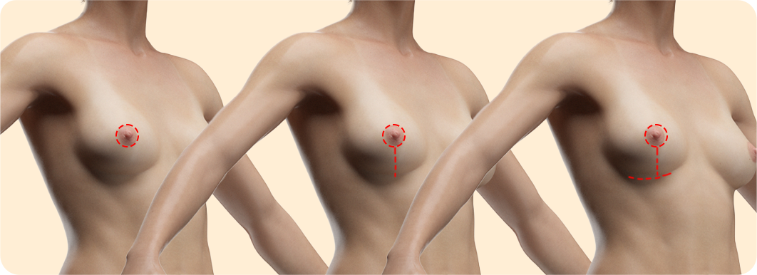 Optimized Responsive Image