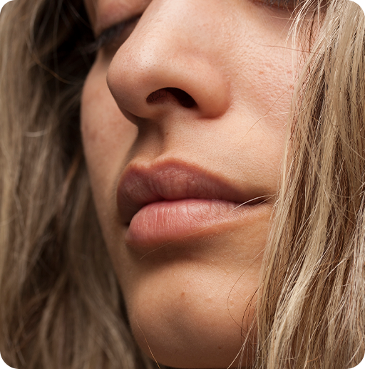 Why Women Choose Lip Lift Surgery