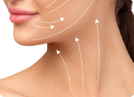 Neck Lift with Permanent Threads: