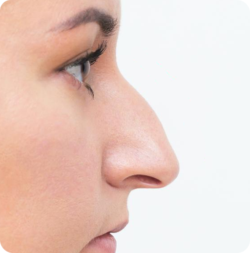 Why Women Choose Nose Makeover