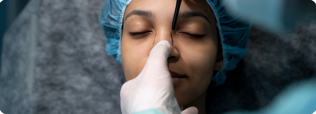 Nose Makeover Techniques