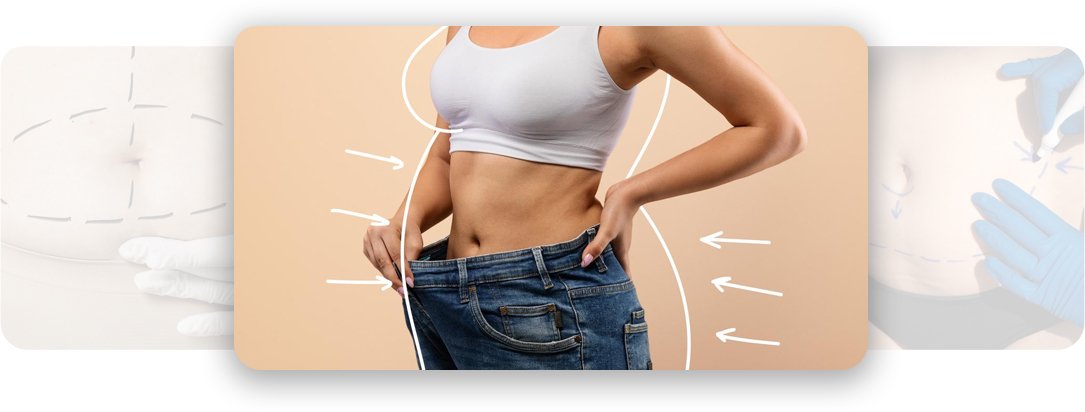 Liposuction - AEONA Aesthetic Clinic