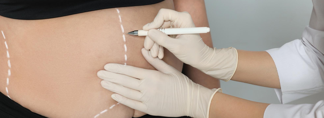 Optimized Responsive Image