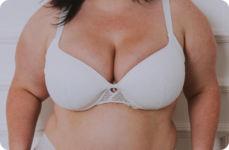 Breast Reduction with Lift