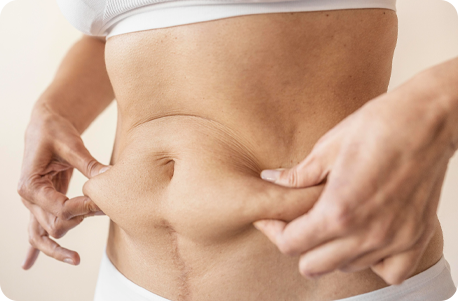 Tummy Tuck Mommy Makeover