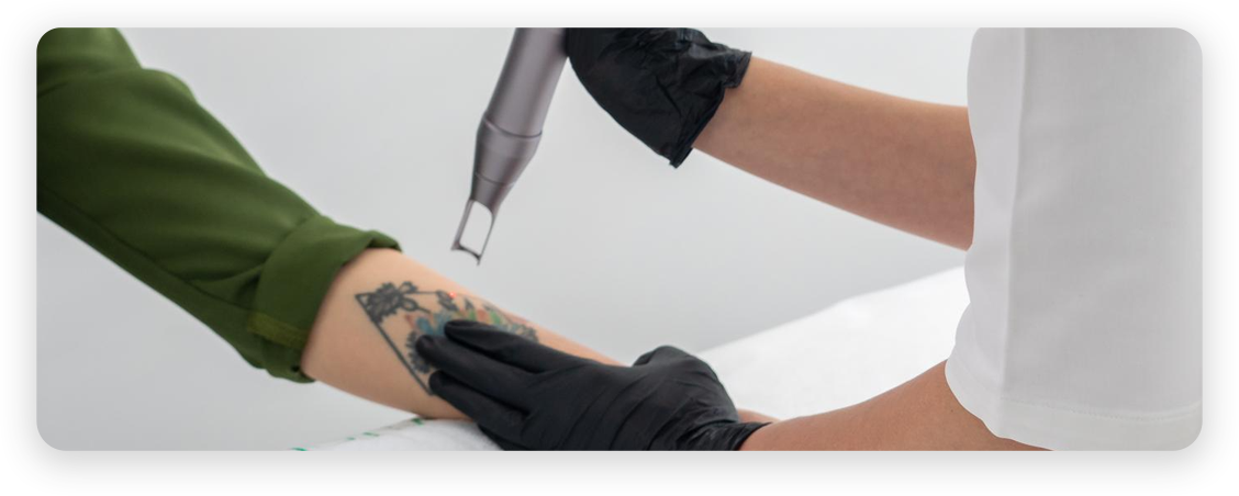 YAG Laser Aftercare
