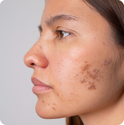 Why Women Choose Pigmentation?