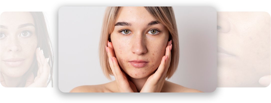 Pigmentation - AEONA Aesthetic Clinic