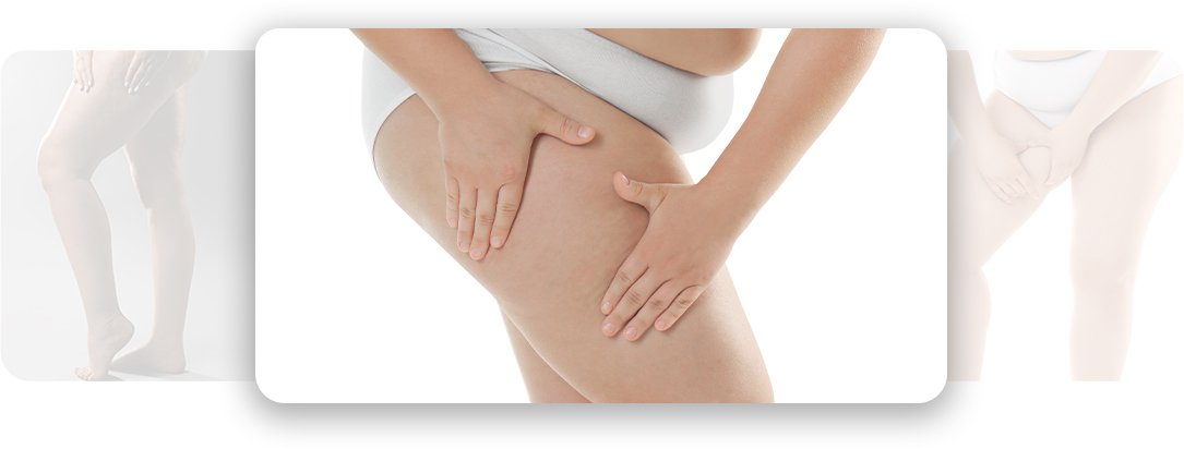 Thighlift - AEONA Aesthetic Clinic