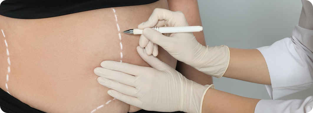 Optimized Responsive Image