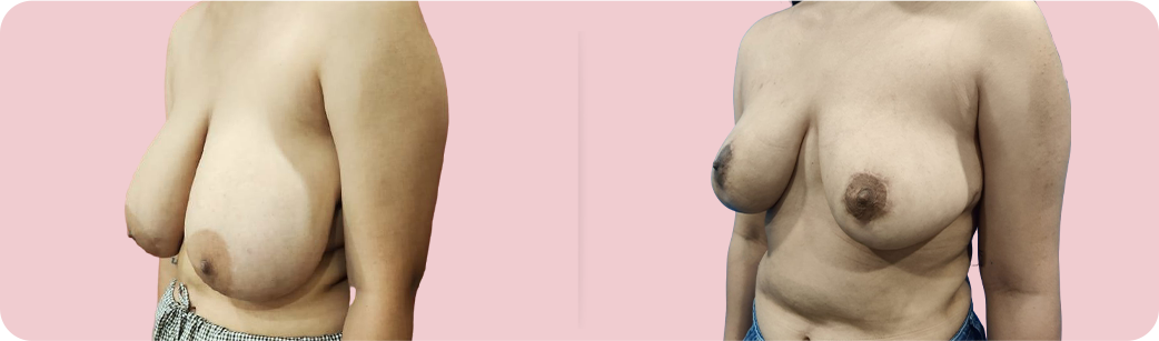 Jessica Before After